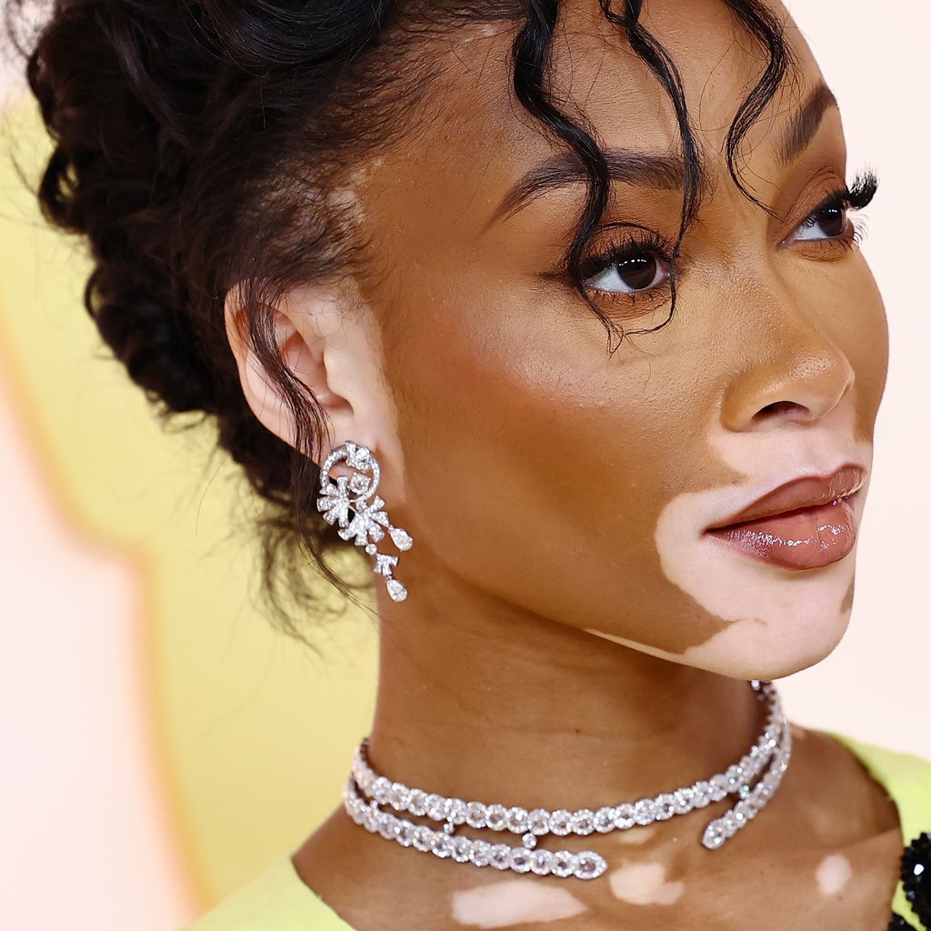 Winnie Harlow im März 2023