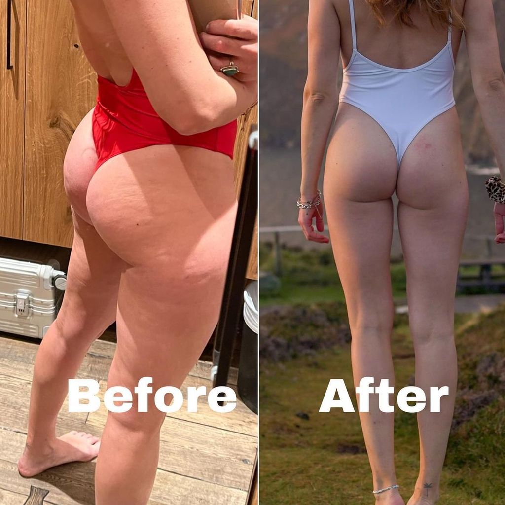 Yvonne Pferrers Beine bevor und nach einer Sporttransformation