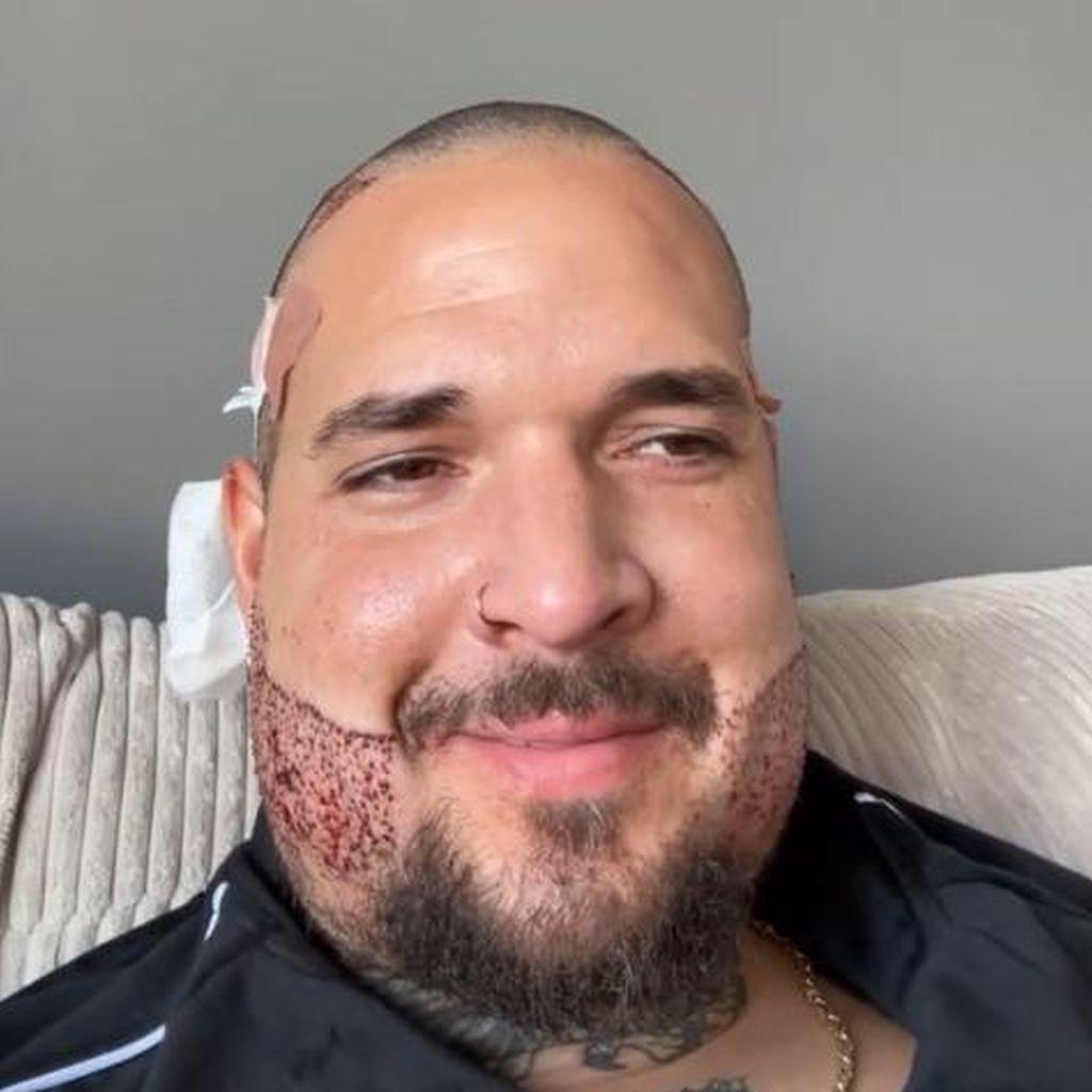 Zico Banach, Realitystar