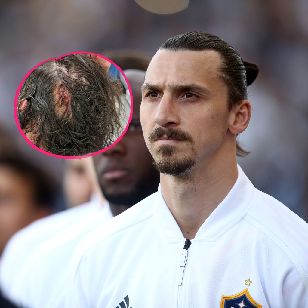 Zlatan Ibrahimovic