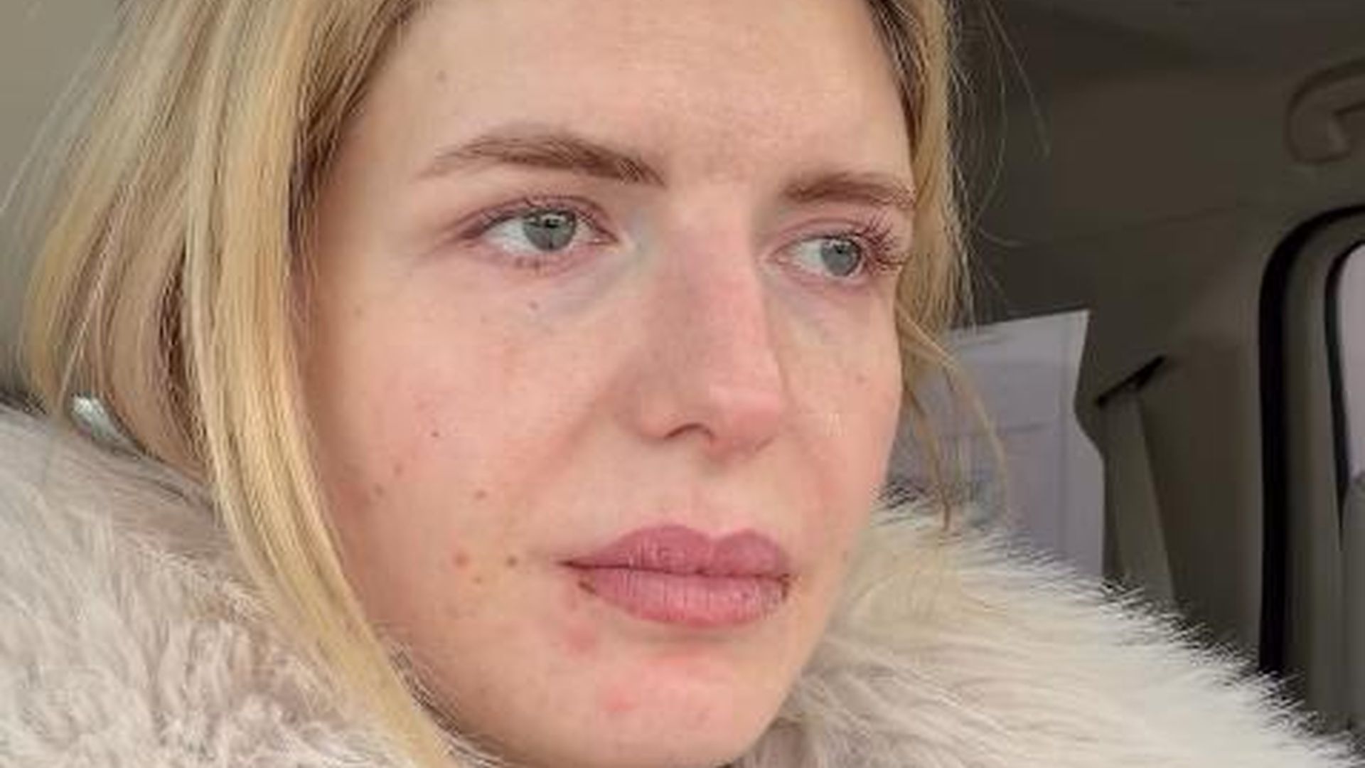 Endometriose-OP-Antonia-Hemmer-meldet-sich-unter-Tr-nen