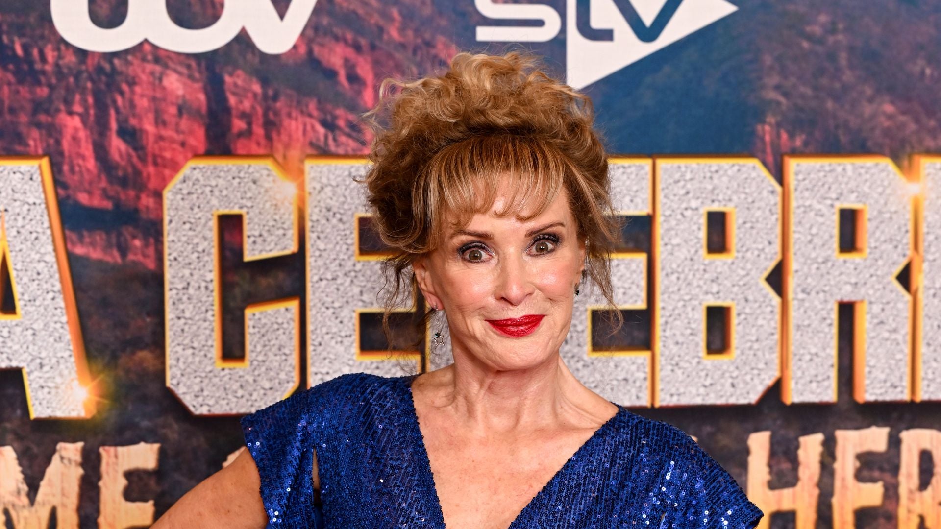 Brustkrebs-Beverley-Callard-wartet-vergeblich-auf-Therapie