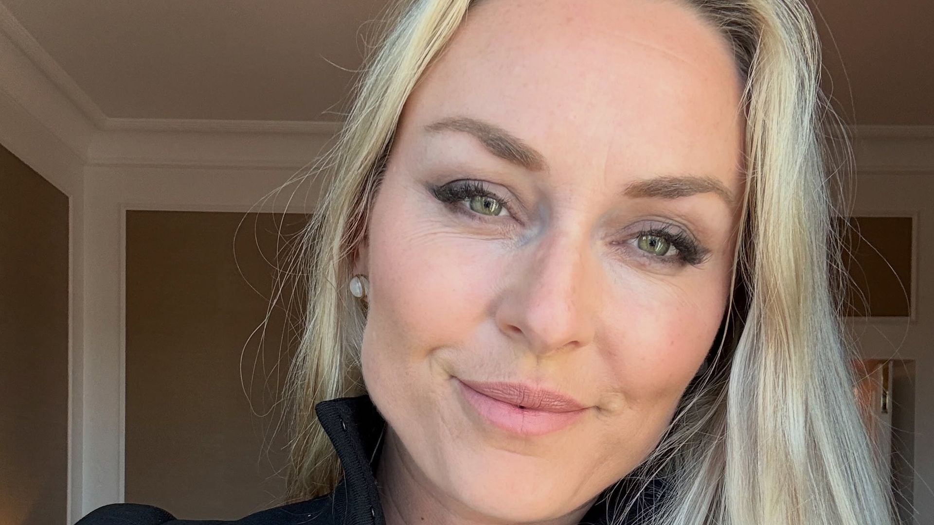 Heftiger-Sturz-Lindsey-Vonn-zeigt-im-Bikini-ihre-OP-Narben