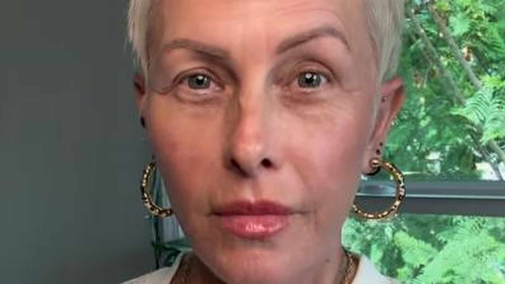 Brustkrebs-Nicole-Eggert-sieht-jeden-Tag-als-Geschenk