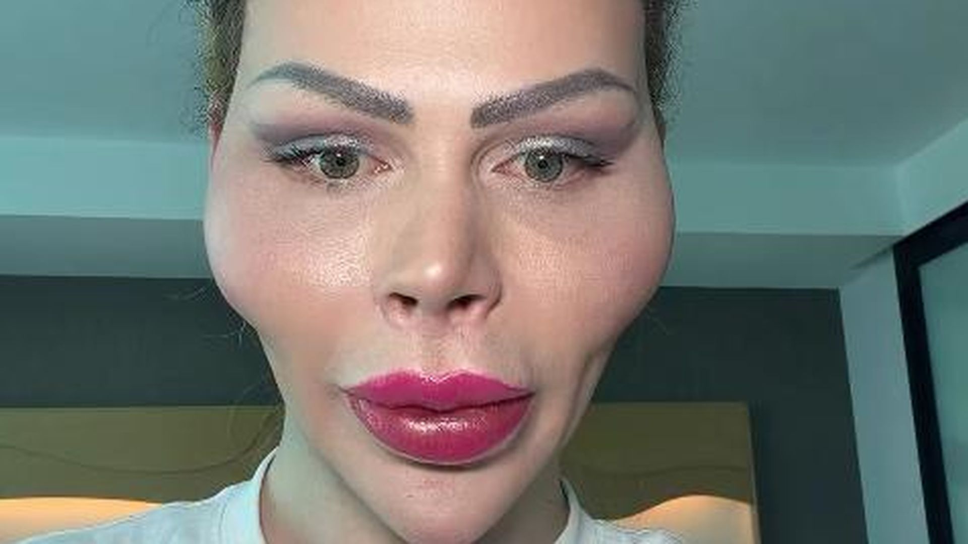 So-viel-Geld-kostete-Dschungelbegleitung-Patricks-Gesicht