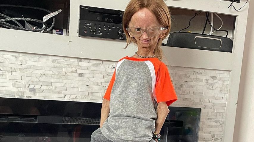 Adalia Rose Williams, YouTuberin