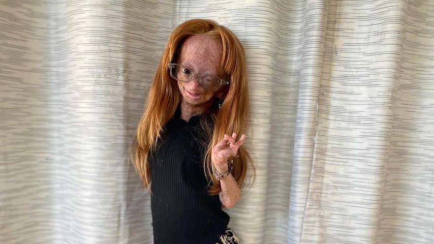 Adalia Rose Williams, Webstar