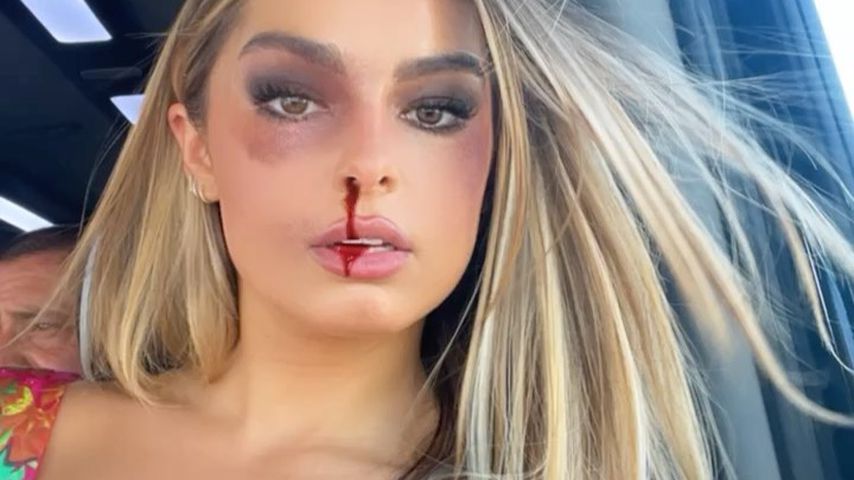Addison Rae mit einem Nasenbluten-Filter