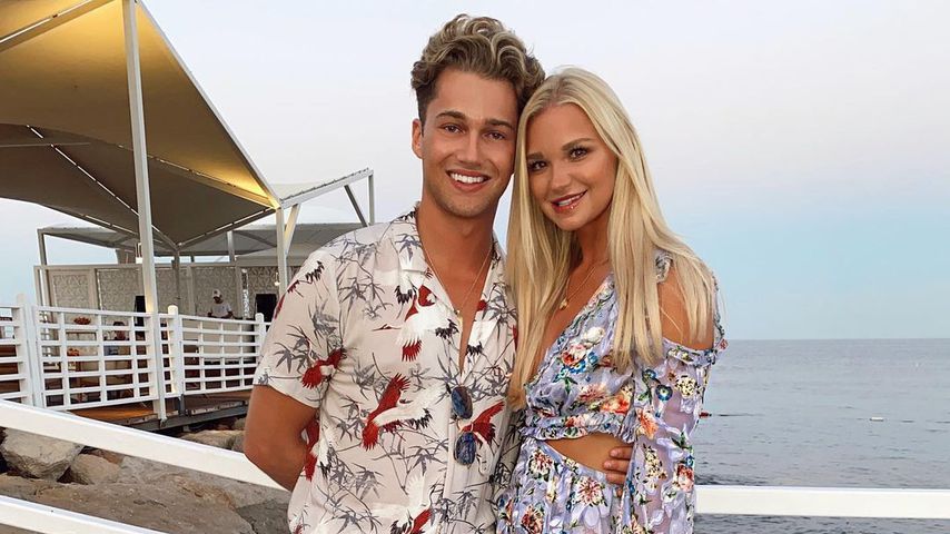 AJ Pritchard äußert sich zu Verbrennungen seiner Freundin