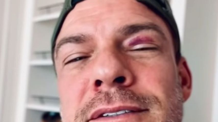 Alan Ritchson kassiert bei "Reachers"-Dreh blaues Auge, Juli 2025