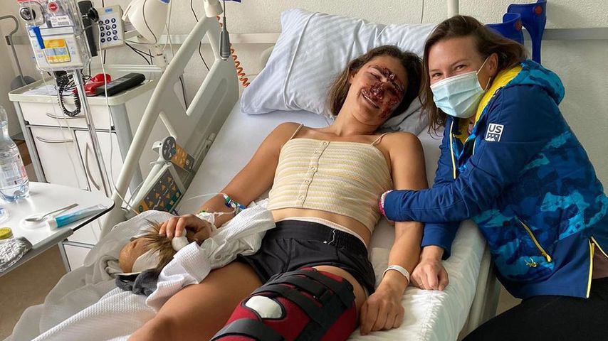 Horror-Crash: US-Ski-Star (24) zeigt heftige Verletzungen!