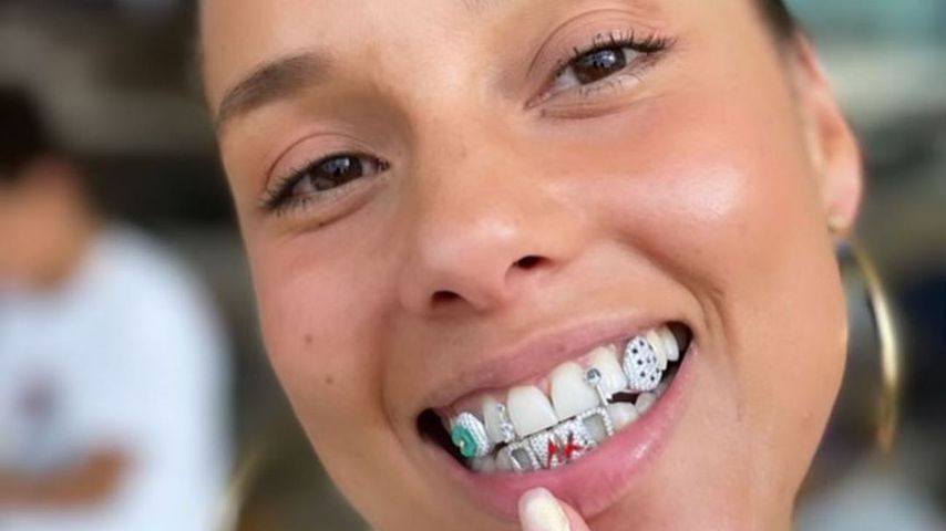 Bitte Zähne zeigen! Alicia Keys hat jetzt luxuriöse Grills