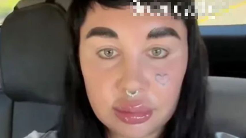 Amanda Bynes präsentiert neue Lippen und Fans sorgen sich