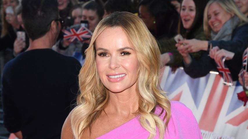 Bei TikTok-Dreh: Amanda Holden verletzt sich an ihrer Hand