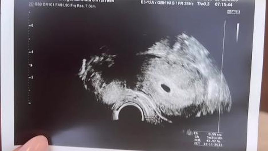 Aminata Sanogos Ultraschallbild