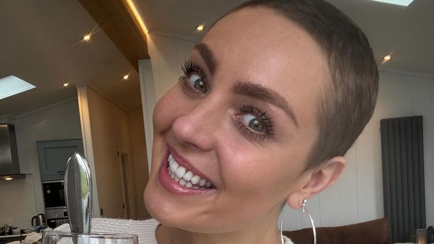 "Starke Schmerzen": Amy Dowden dachte, Krebs sei in Knochen!