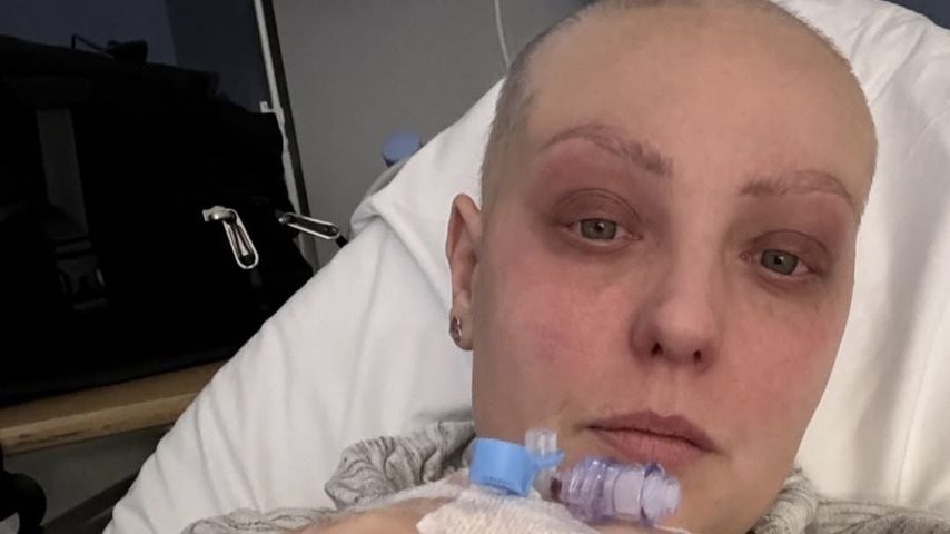 Amy Dowden teilt Vergleich nach Krebskampf