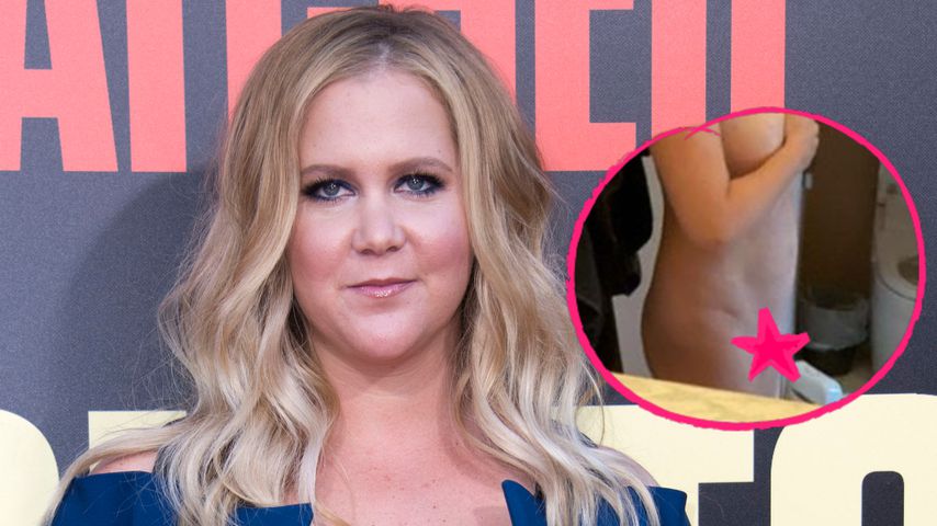Nackt-Selfie: Amy Schumer zeigt ihre Kaiserschnittnarbe!