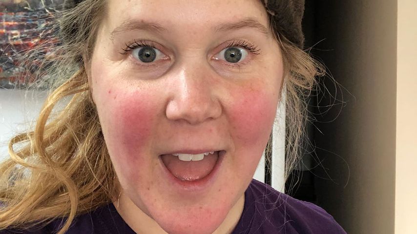 Künstliche Befruchtung: Wird Amy Schumer bald wieder Mama?