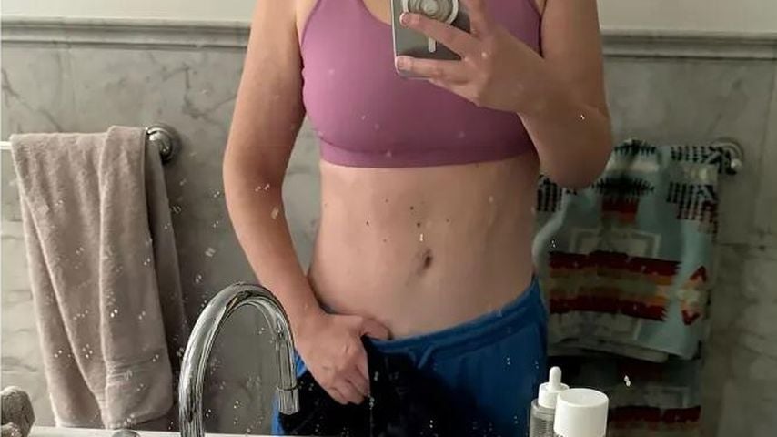 Komikerin Amy Schumers Bauch