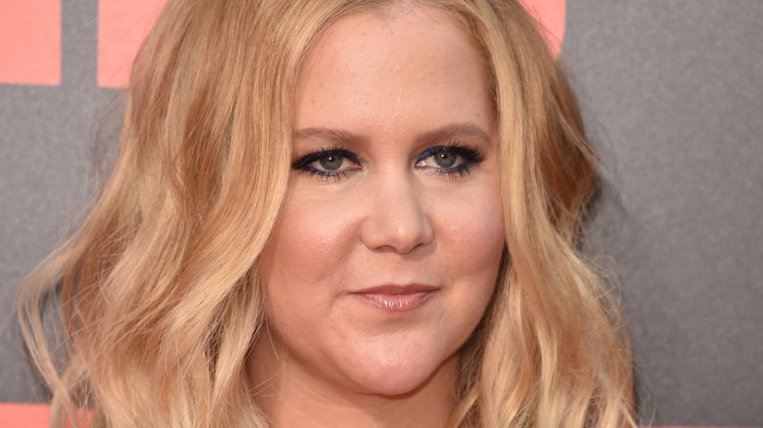 Witziges Throwback-Pic: So sah Amy Schumer ohne Zähne aus!