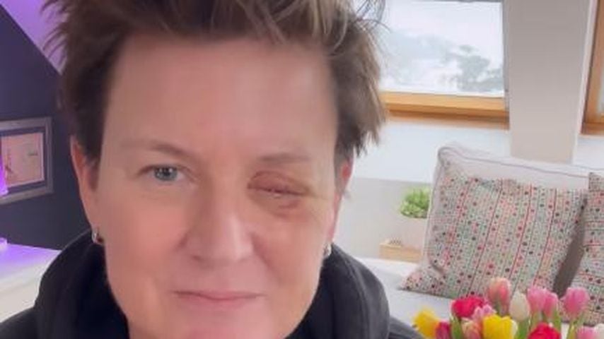 "Astro TV"-Star Andrea Plewig verliert Auge durch Feuerwerk
