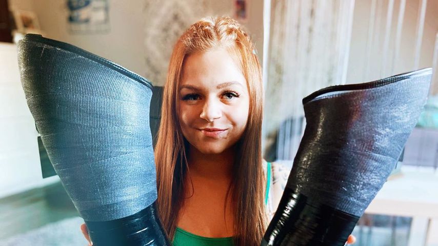 Angie Berbuer mit ihren Prothesen