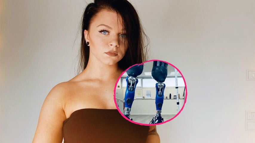 Angie verlor beide Beine – und ist jetzt ein Tik-Tok-Star