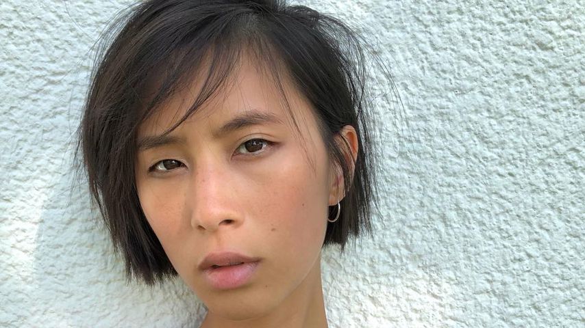 Final-Schock für GNTM-Fans: Anh wegen OP nicht dabei!