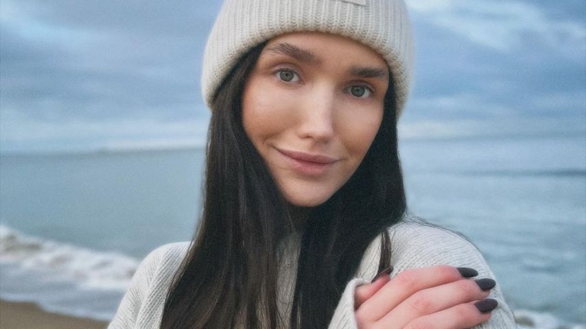 "Pickelig": Anna Adamyan scherzt über Schwangerschaftsglow