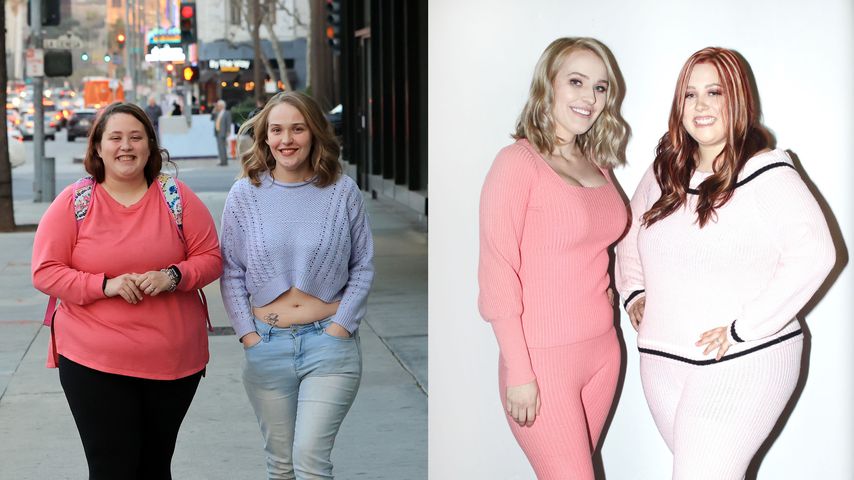 Anna Cardwell und Jessica Shannon vor und nach ihren Beauty-OPs