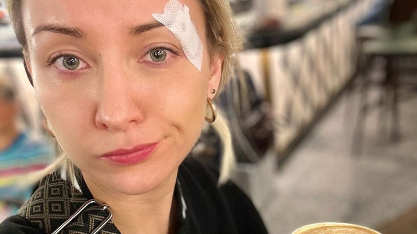 Duschunfall: Anna-Carina Woitschack hat eine Platzwunde!