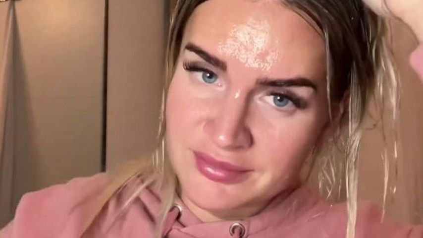 Haar-Fail: Anna Iffländer hat kahle Stellen auf dem Kopf!