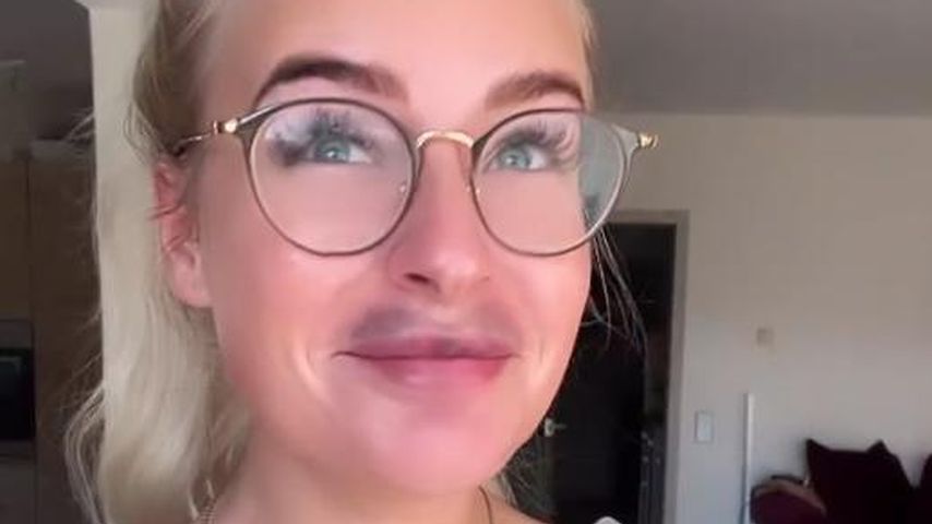 Aua! Anna Iffländers Mund ist nach Hyaluronauflösung blau