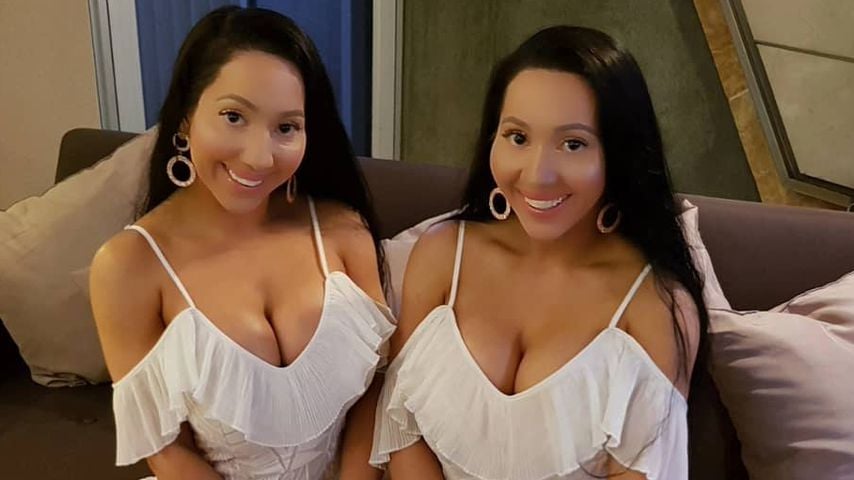 Identisch operiert: Crazy Twins teilen sich sogar einen Mann