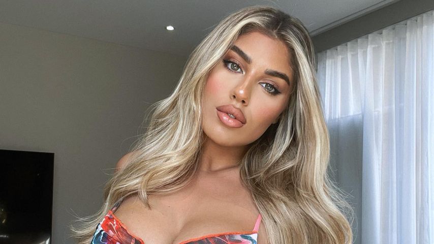 Beauty-Fauxpas: "Love Island UK"-Anna dachte, sie stirbt!