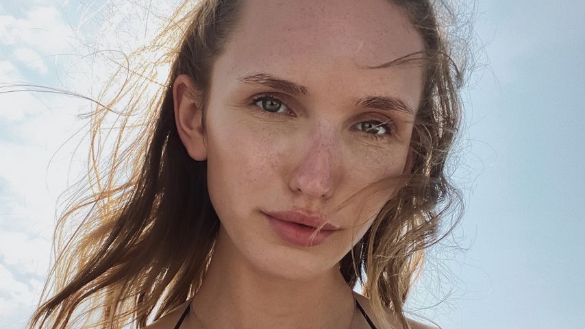 "Emotionen und Schmerzen": Anna Wilken meldet sich nach OP