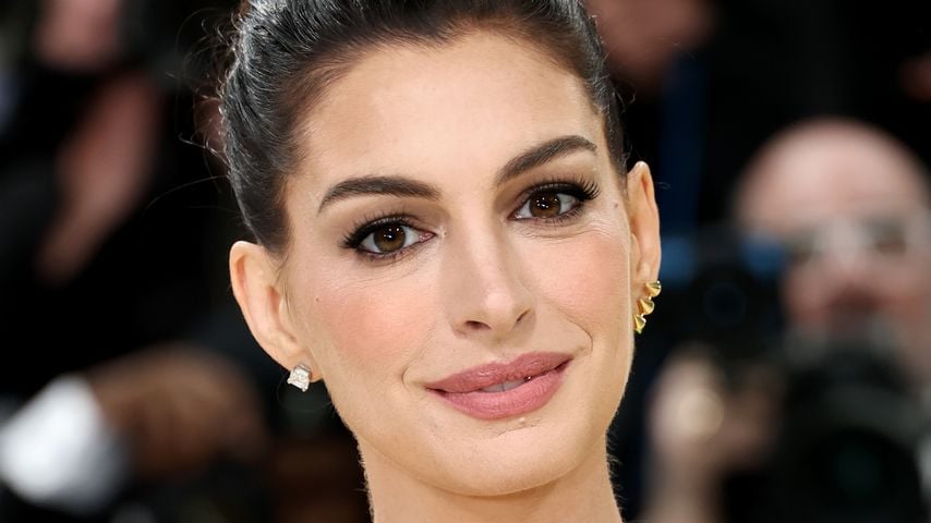 Anne Hathaway war zehn Jahre auf einem Auge praktisch blind