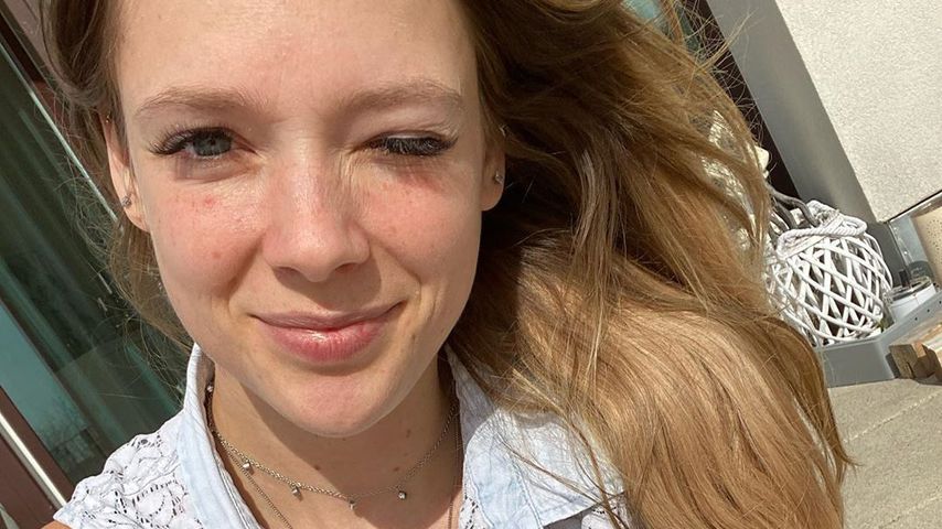Haut-Kritik: Anne Wünsche äußert sich gegen Beauty-Filter