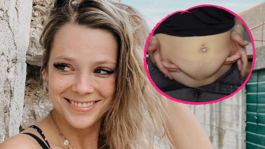 "Schwabbel": Anne Wünsche zeigt authentisch After-Baby-Body