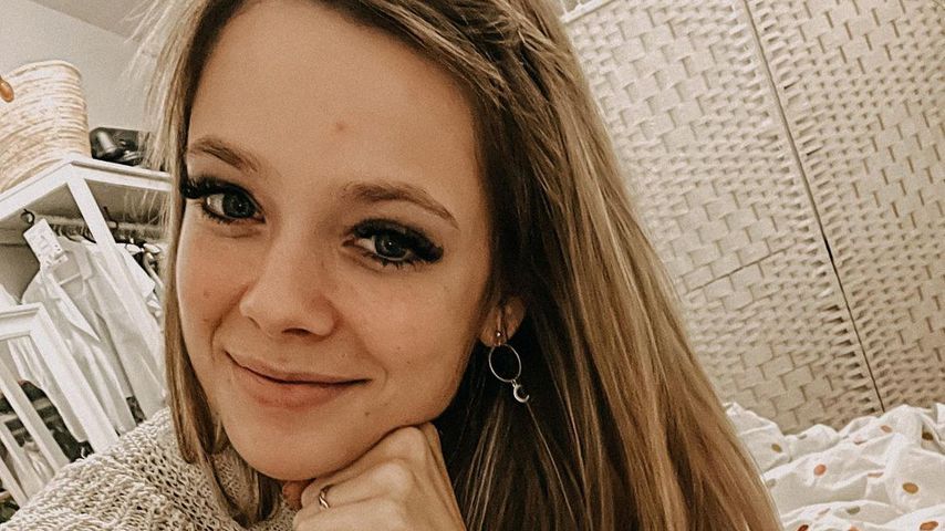 Hautprobleme: Anne Wünsche schämt sich nicht für Pickel