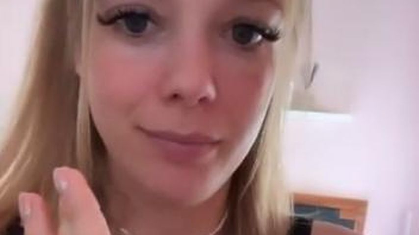 "Sieht gar nicht gut aus": Anne Wünsche hat Daumenschmerzen