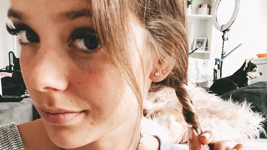 "Haarmenge halbiert": Anne Wünsche leidet unter Haarausfall