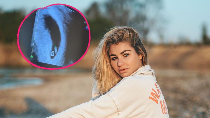 Antonia Elena teilt erste Ultraschallaufnahme ihres Babys!