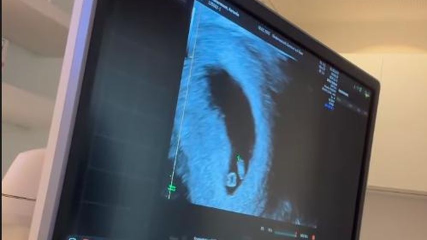 Antonia Elena zeigt ihr Ultraschallfoto im August 2023