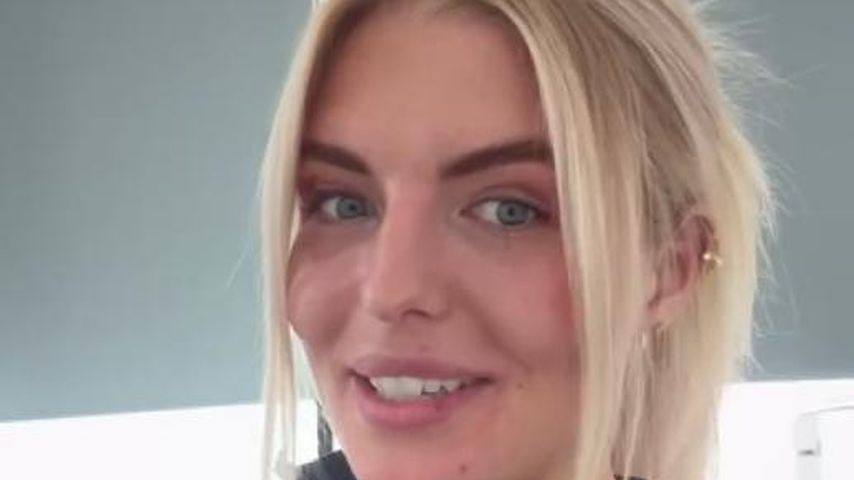 Fäden gezogen: Antonia Hemmer zeigt Ergebnis von Augenlid-OP
