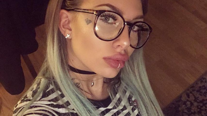 Mobbing: Darum ließ sich DSDS-Antonia die Lippen aufspritzen