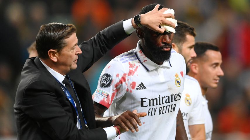 DFB-Star Antonio Rüdiger geht blutüberströmt vom Spielfeld
