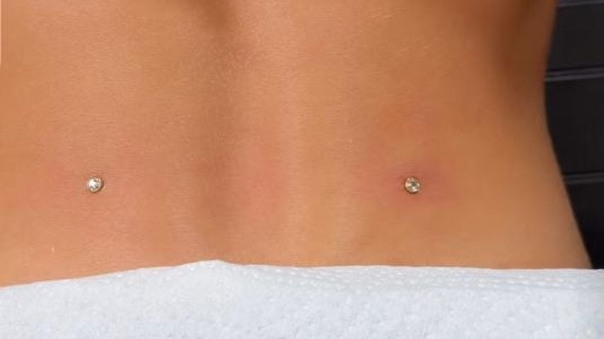 Ariels Dermal-Piercing am Rücken, Juli 2026