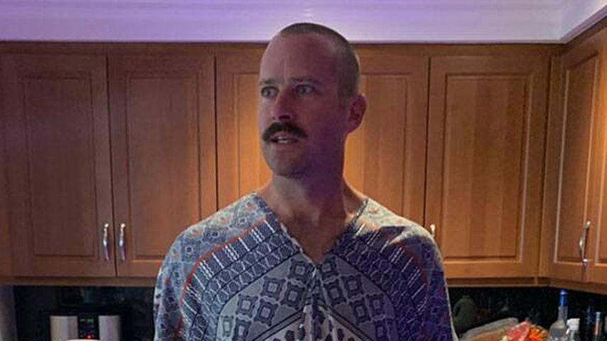 Verwandlung: Armie Hammer überrascht im Netz mit Glatze